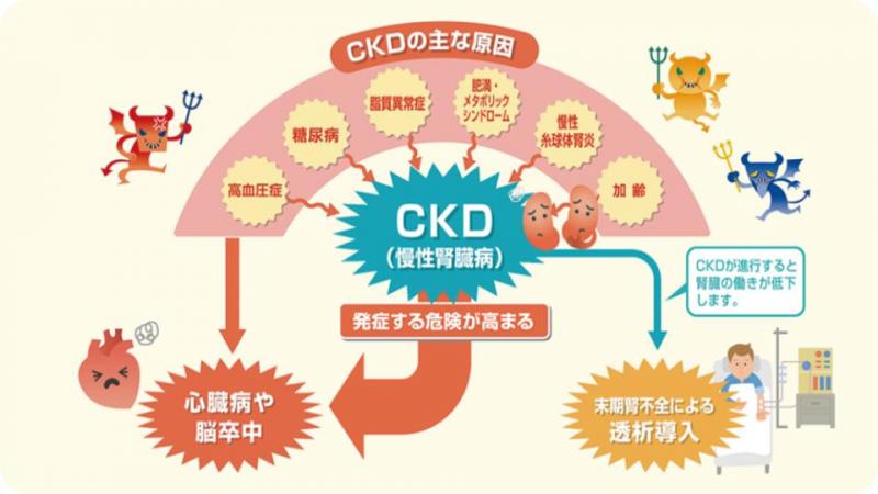 ckd